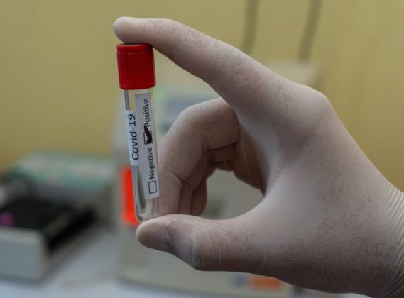 Reino Unido registra 1ª morte por infecção da cepa ômicron