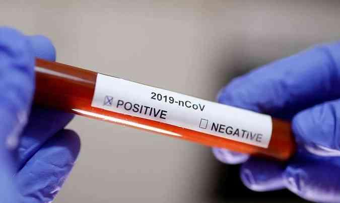 Com aumento de casos, Salvador entra em ‘descontrole epidemiológico' para Covid-19