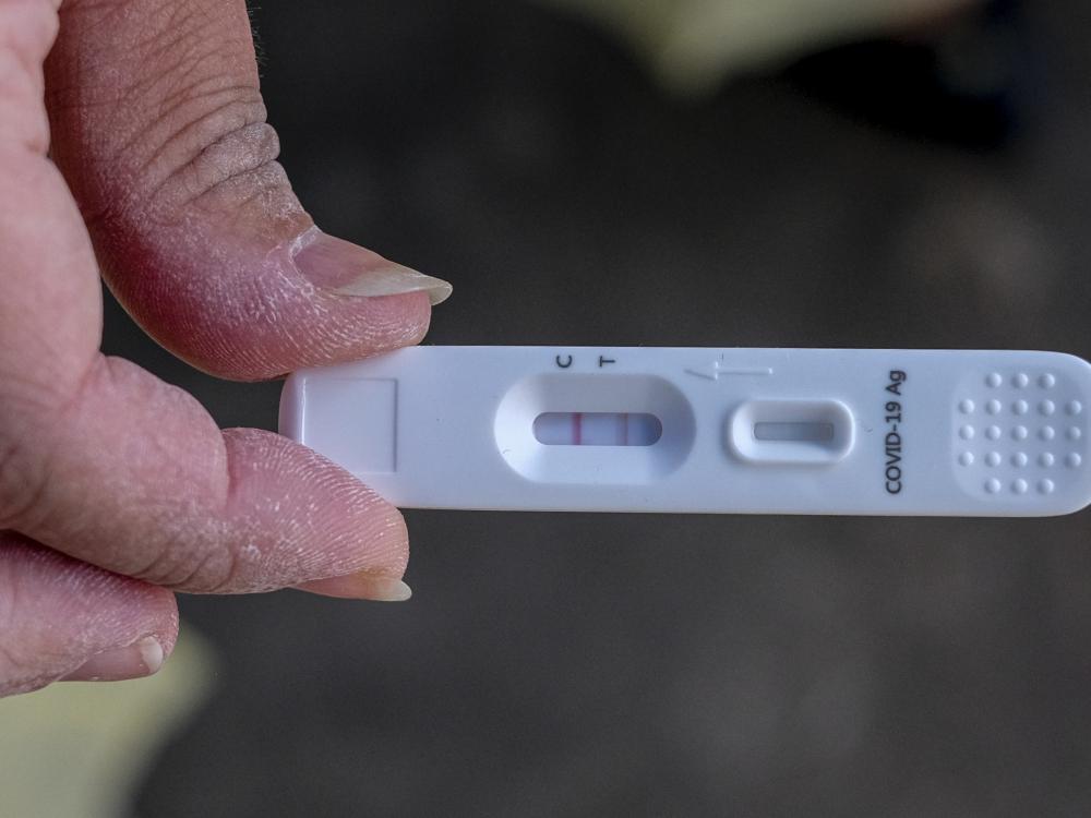 Teste rápido de Covid deve ter cobertura obrigatória por plano de saúde, decide ANS