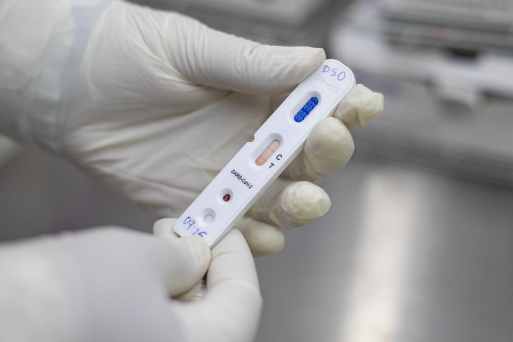 Mais da metade dos testes de covid examinados pelo Lacen na Bahia dão positivo