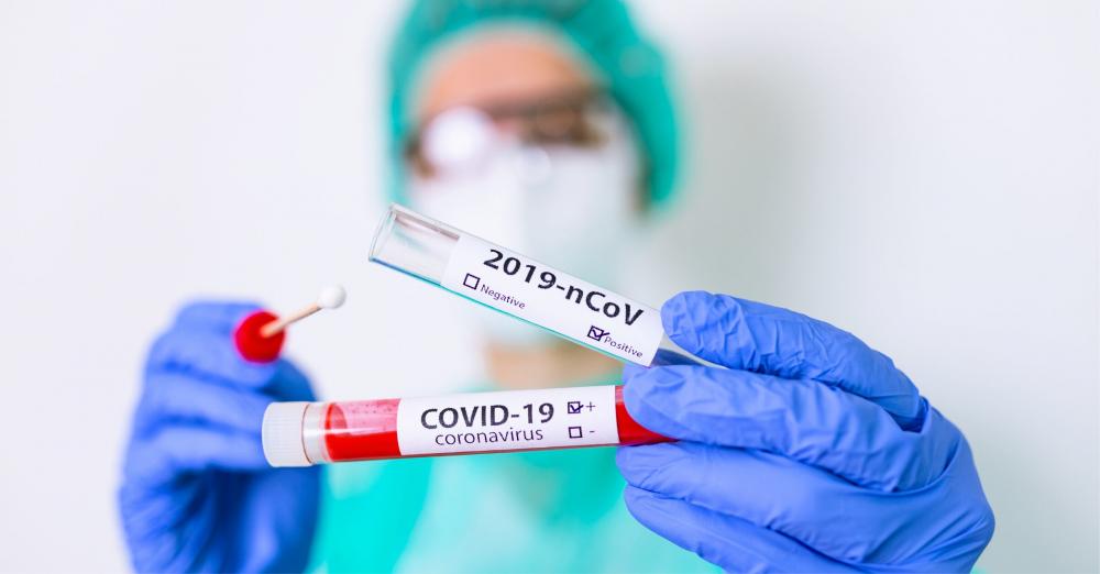 Afastamento de trabalhador por Covid-19 cai para 10 dias