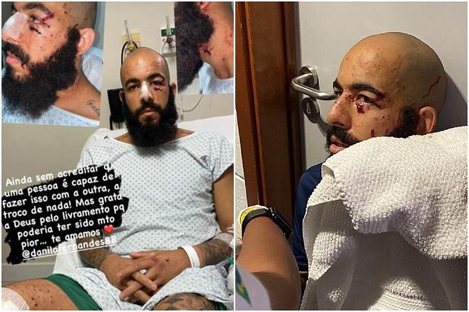 Danilo Fernandes mostra ferimentos: 'É preciso que todos vejam o que aconteceu'