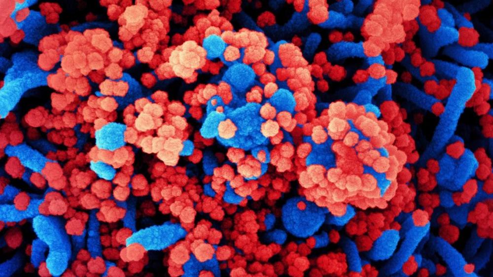 Coronavírus infecta pênis, testículos e próstata de macacos em estudo dos EUA