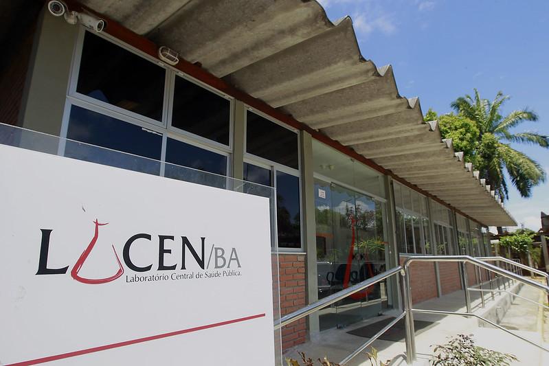 Lacen registra queda de 86% nos diagnósticos de Covid-19 em menos de 20 dias