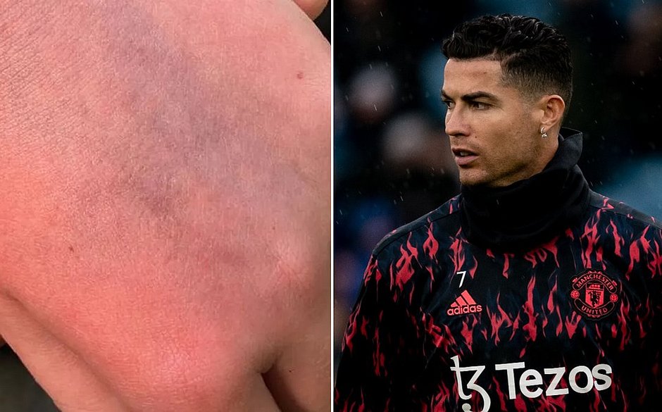 CR7 é investigado por agressão após tapa em torcedor autista