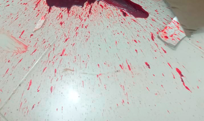 Homens invadem casa e matam jovem em residencial no Amado Bahia 