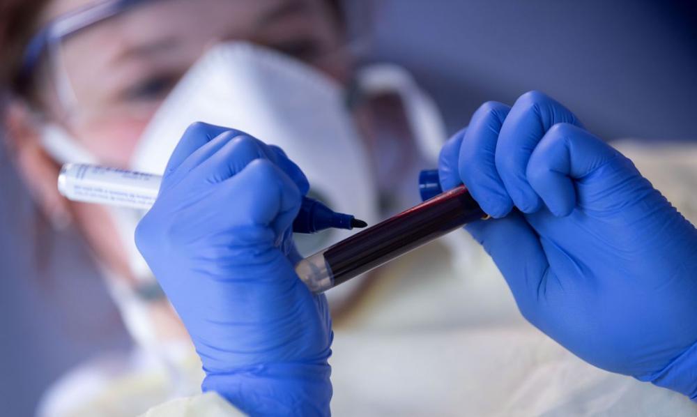 Bahia tem aumento de 166% em casos conhecidos de Covid-19 e procura por testes disparam