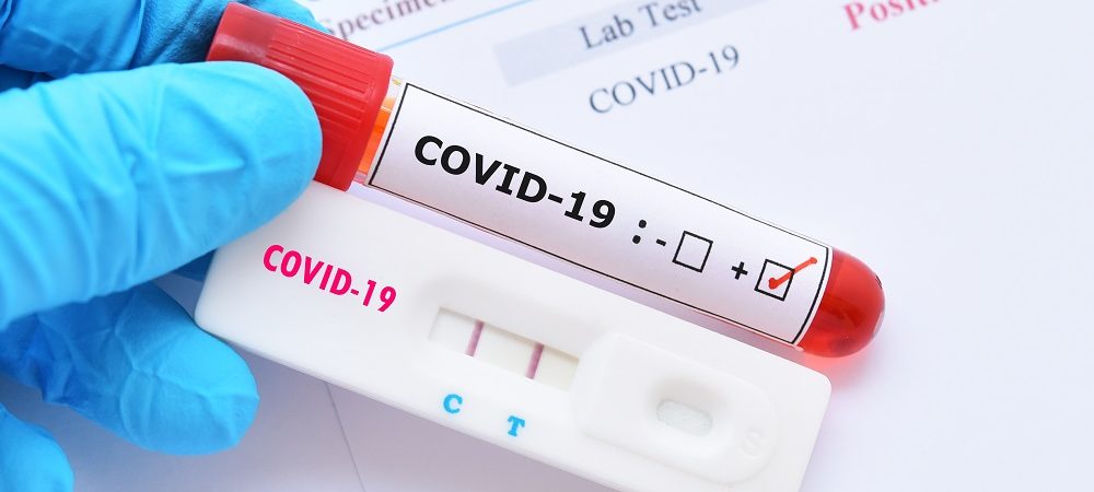 Bahia registra 4.000 casos ativos de Covid e mais seis mortes em 24h