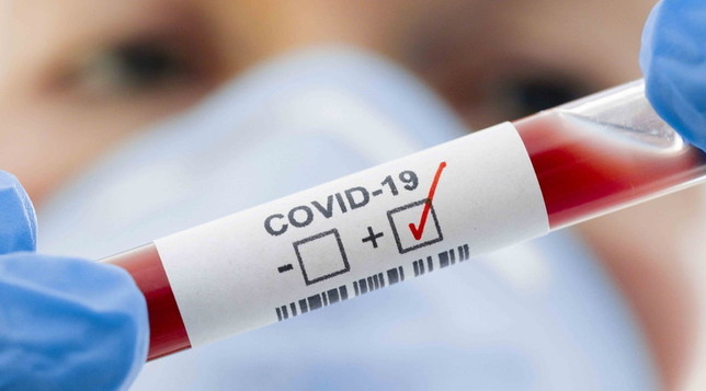 Micronésia registra primeiro surto de covid-19, com mais de mil casos
