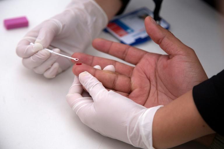 Cientistas anunciam quarto caso no mundo de paciente curado do HIV