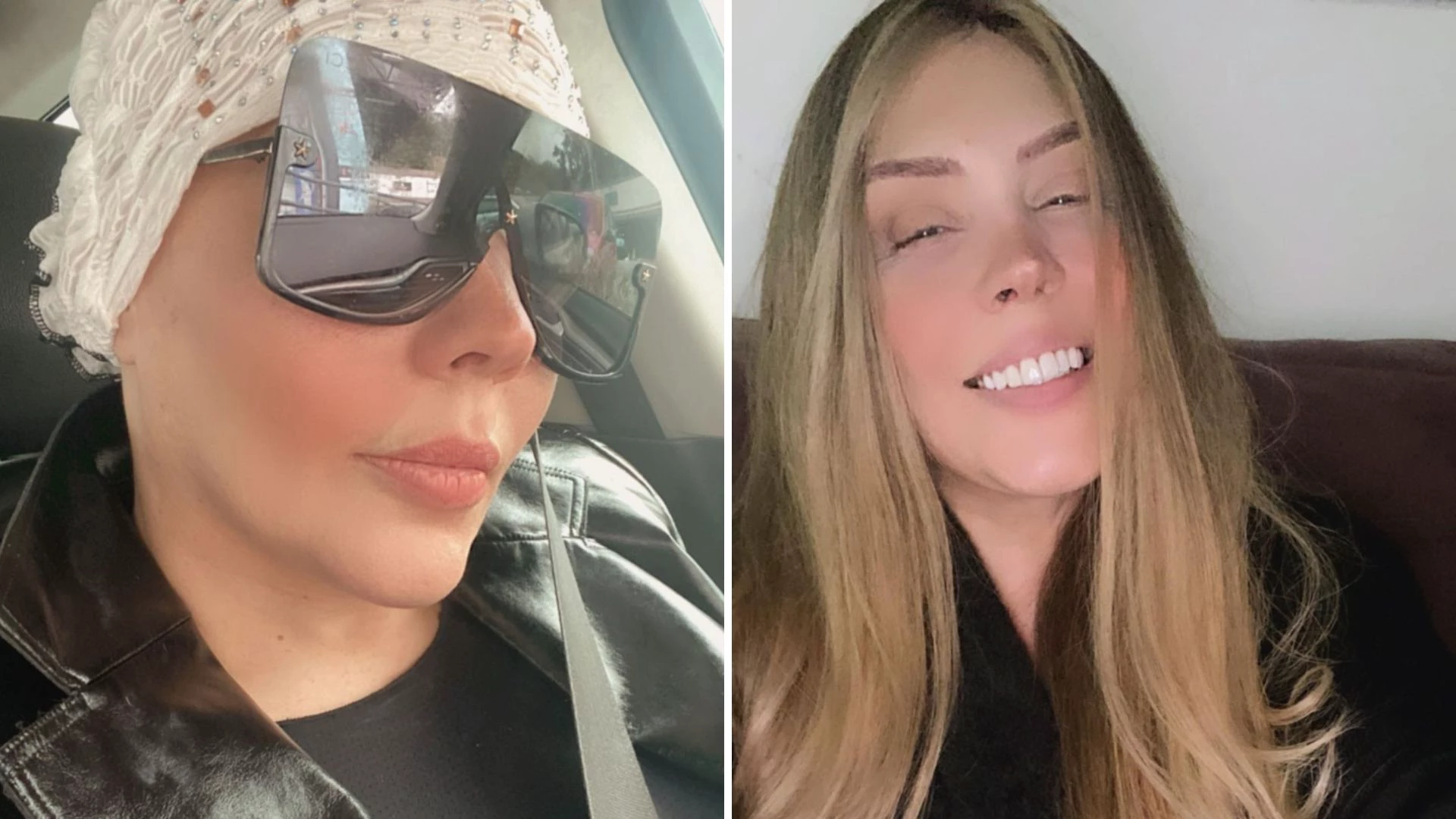 Simony sobre perda de cabelo devido à quimio: “Super difícil”
