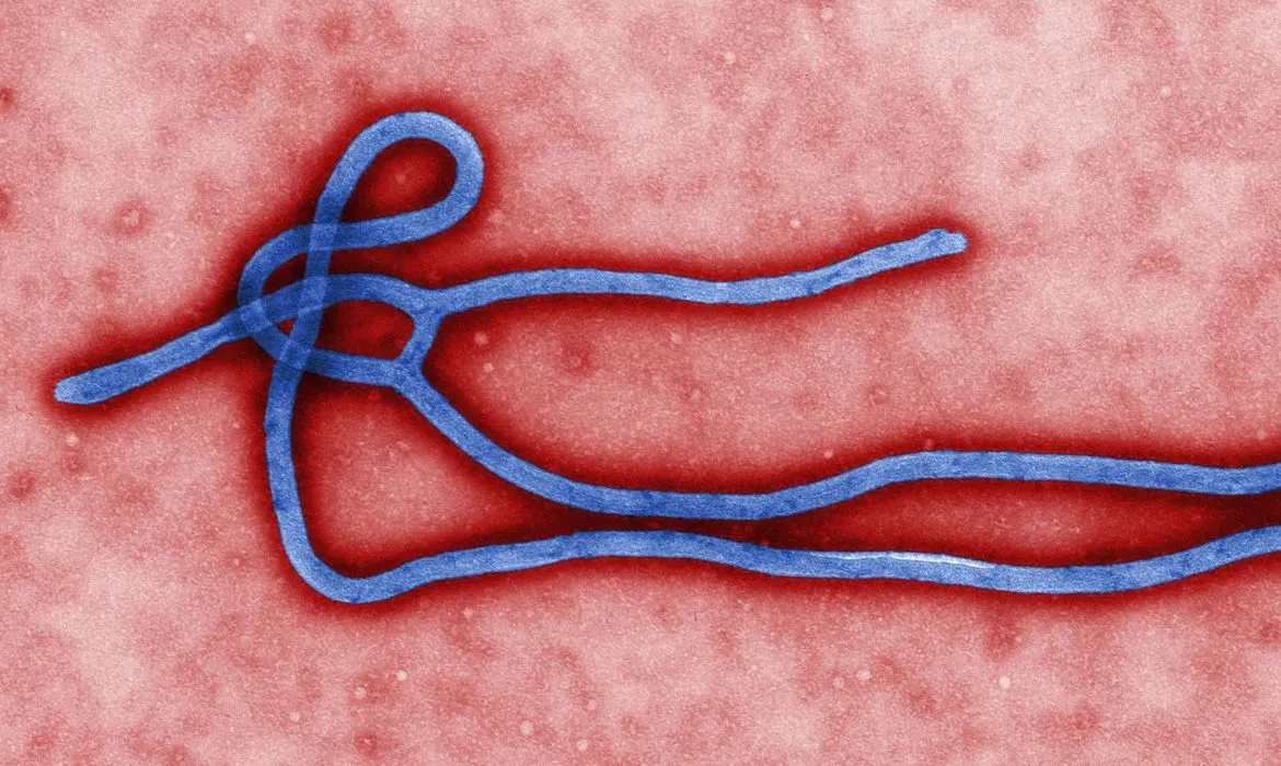 Em meio a surto de ebola, Uganda registra 5 mortes pela doença