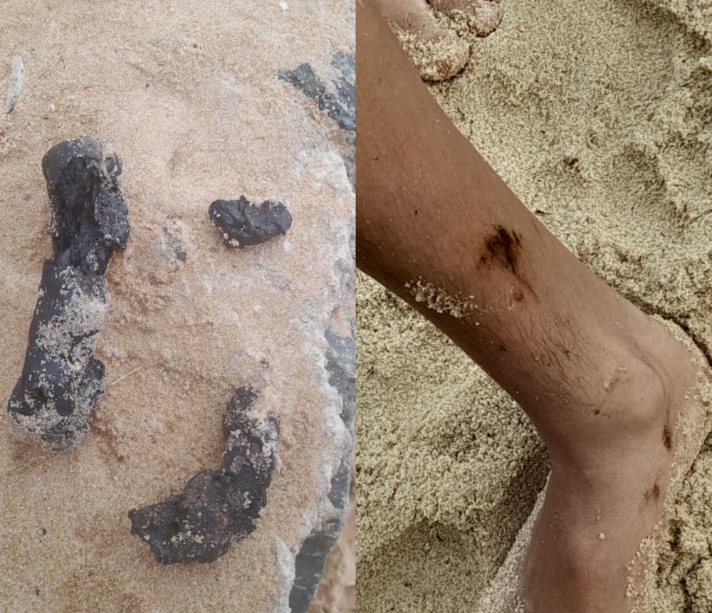 Manchas de óleo voltam a aparecer em praias de Mata de São João