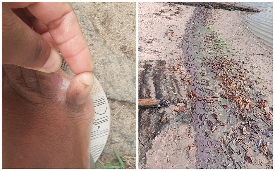 Pessoas sofrem coceira e mal-estar após contato com substância desconhecida em Barra do Jacuípe