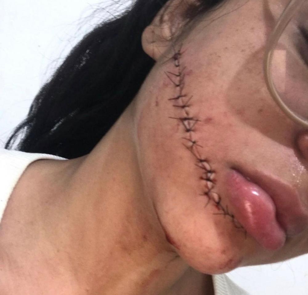Mulher é esfaqueada no rosto enquanto dormia em viagem de ônibus para Salvador