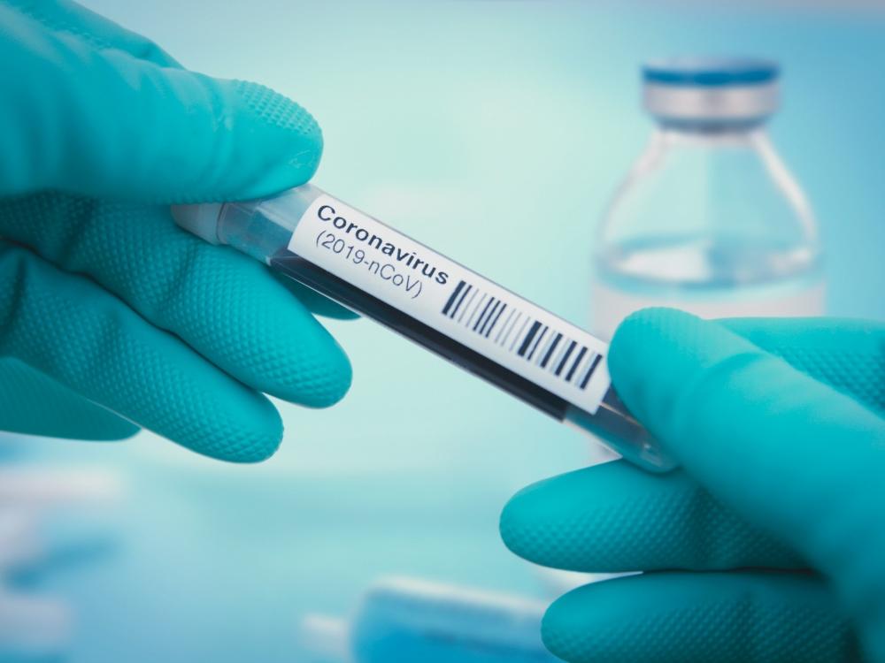 Teste detecta anticorpos da Covid a custo abaixo de R$ 1
