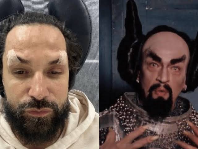 Cantor Latino faz rejuvenescimento facial e é comparado a “demônio” de O Auto da Compadecida