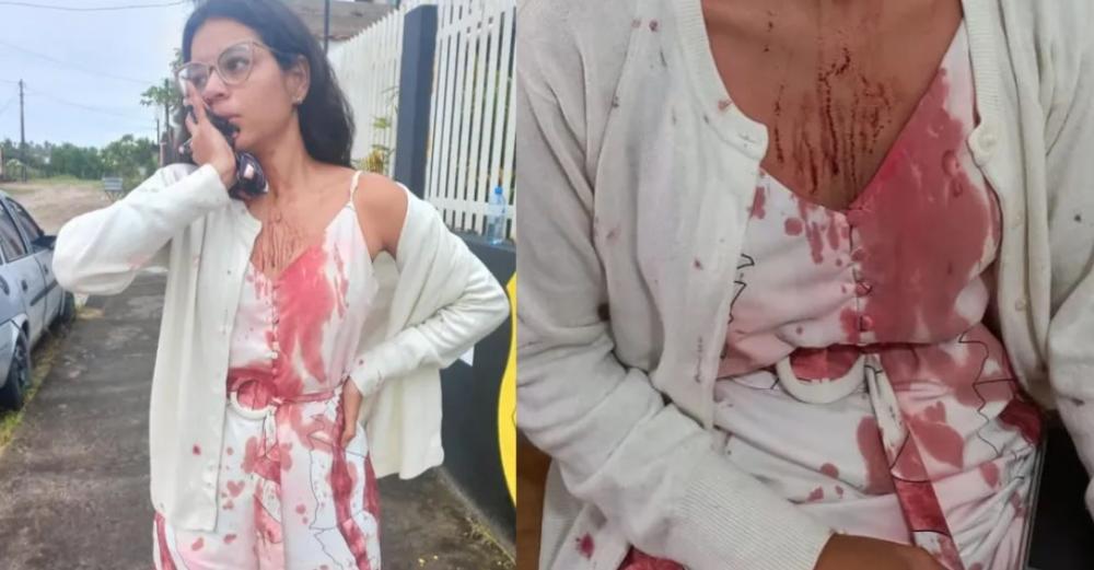 Caso de jovem que teve rosto cortado em ônibus na Bahia completa um mês