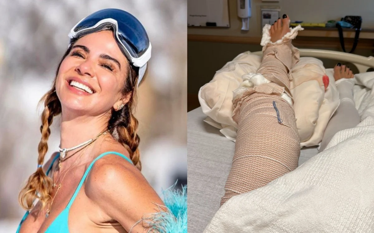 Luciana Gimenez recebe alta após grave acidente: ‘Fará uso de cadeira de rodas’