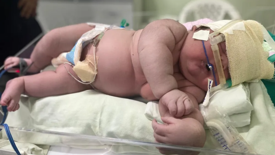 Bebê nasce com mais de 7kg e choca redes sociais
