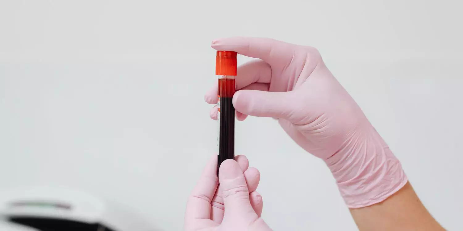 Ciência registra quinto caso de paciente curado do HIV no mundo