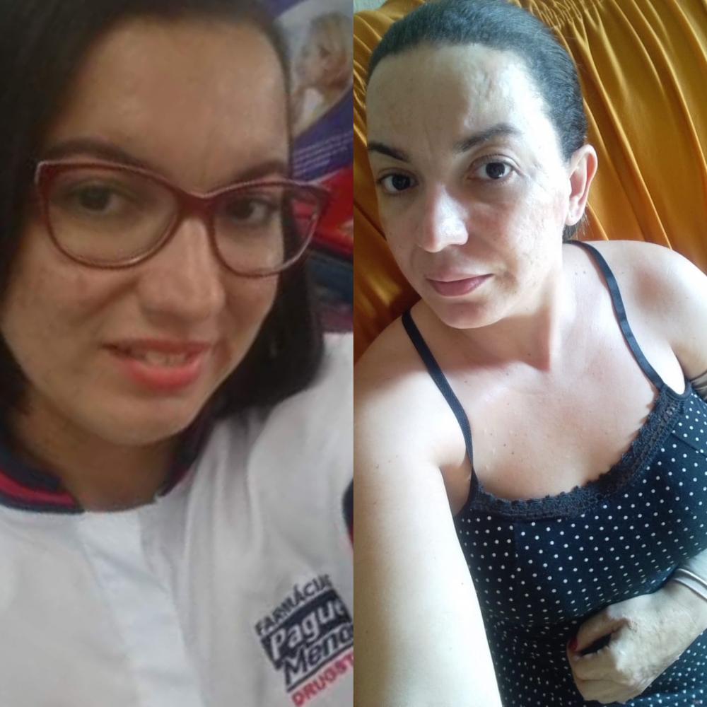 Vítima de tragédia da Pague Menos em Camaçari reivindica assistência da empresa