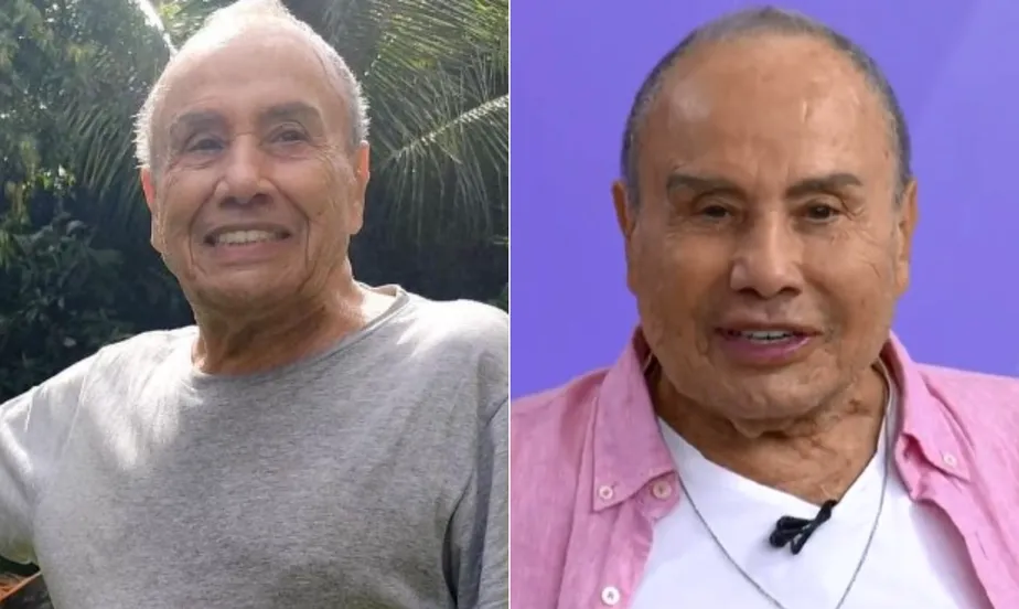 Stênio Garcia faz harmonização facial e vira alvo de comparações na web