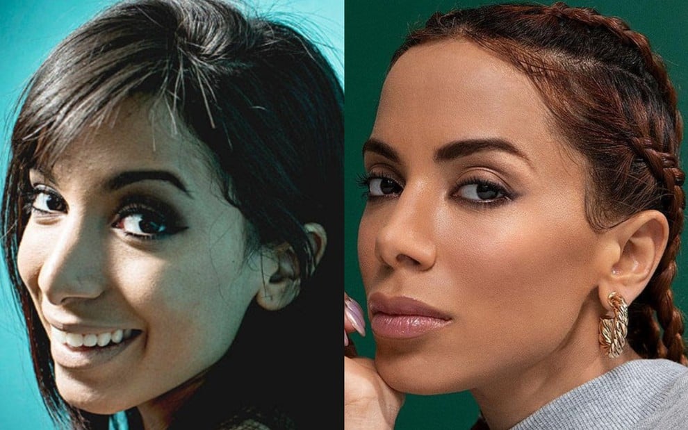 Anitta abre o coração e revela sobre críticas das cirurgias: 'Fiquei muito mal'