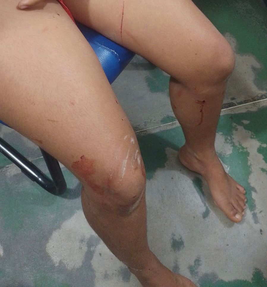 Homem está foragido por lesão corporal e tentativa de estupro em Monte Gordo