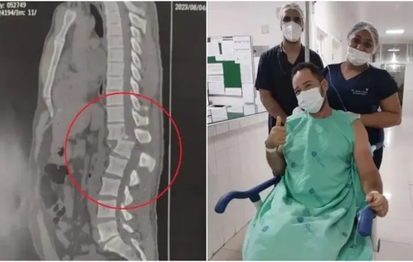 Aluno que ficou paraplégico após ser atingido por aparelho em academia volta a sentir as pernas
