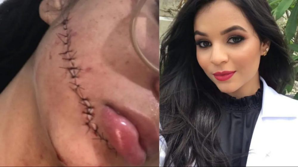 Mulher que cortou rosto de estudante em ônibus na Bahia é presa em São Paulo