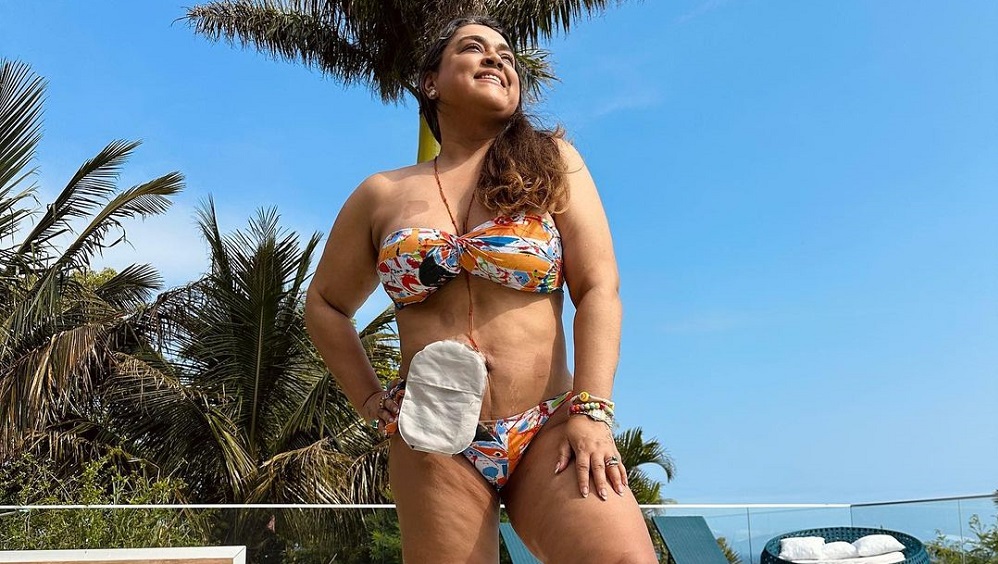 Preta Gil passa por cirurgia para retirar bolsa de ileostomia