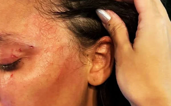 Mulher leva soco após usar banheiro feminino e ser confundida com trans 