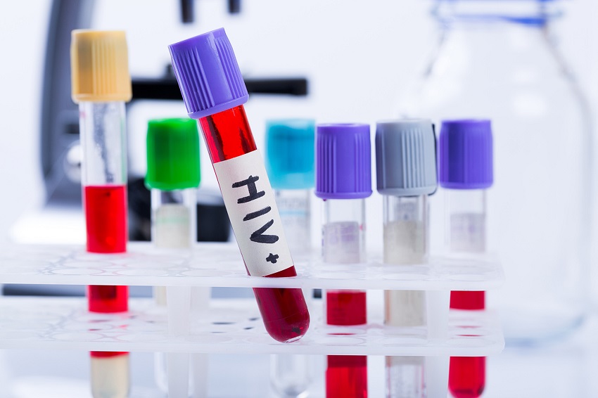 Ministério da Saúde distribui novo medicamento para pacientes com HIV