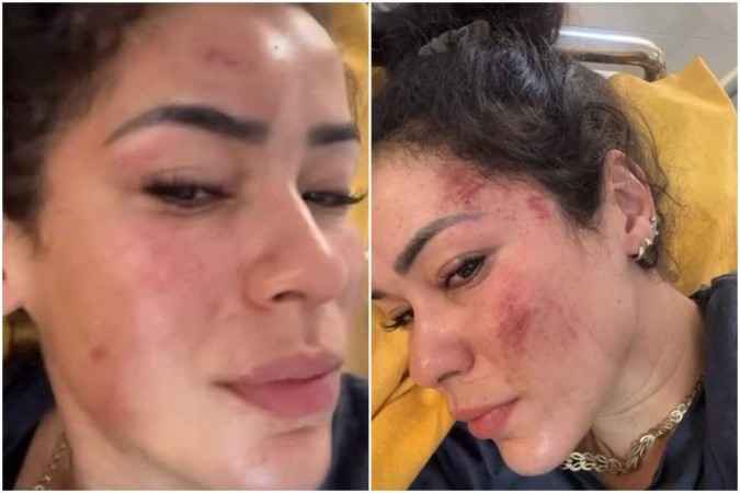 'Achei que ia morrer', diz brasileira que sofreu estupro coletivo na Índia