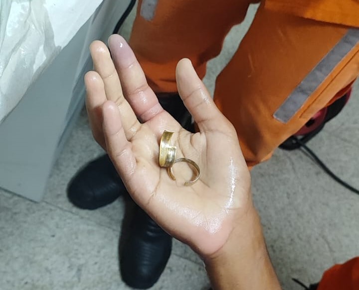 Bombeiros retiraram um anel preso no dedo de um adolescente em Camaçari