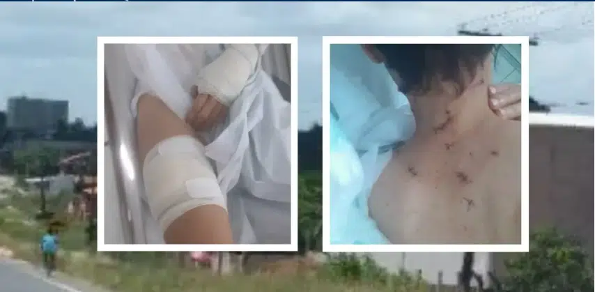 Motorista por aplicativo é esfaqueada após aceitar corrida para Camaçari
