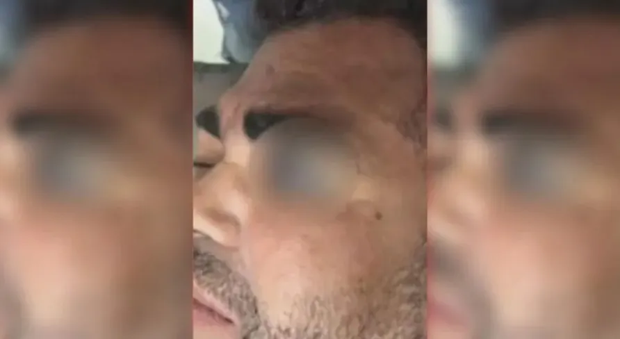 Guardas municipais são suspeitos de agredir homem com madeira