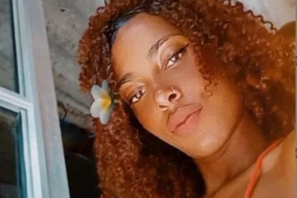 Jovem de 18 anos morre após ser queimada com água quente