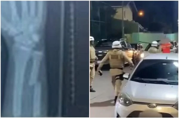 Jovem tem fratura no braço após agressão de PM em Barra do Jacuípe, denuncia família