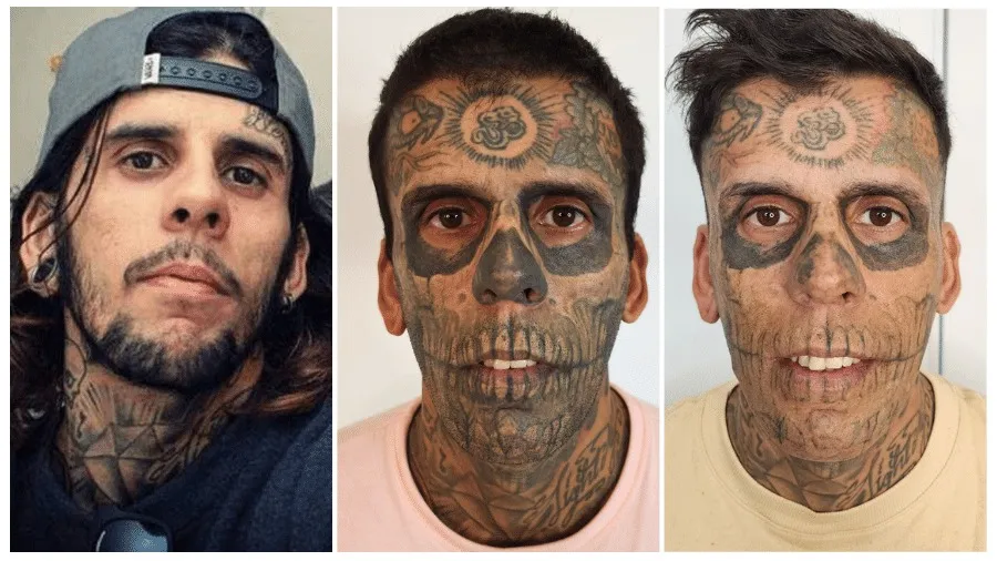 'Homem mais tatuado do Brasil' vira evangélico e remove tatuagens