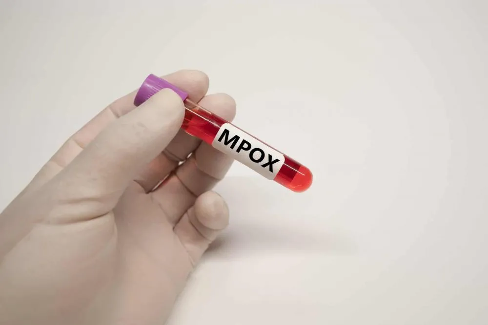 Brasil é o 2º país com mais casos de mpox, aponta OMS