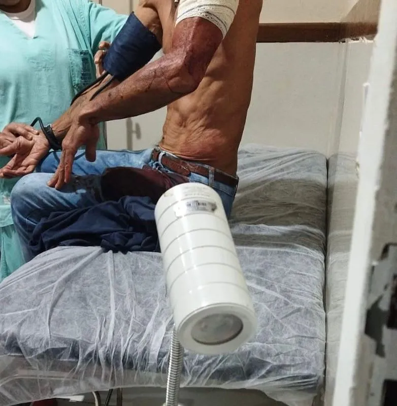 Homem é baleado durante tentativa de assalto na Linha Verde 