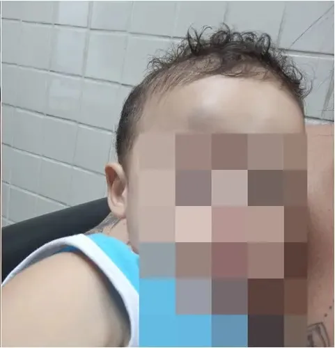 Bebê de 11 meses cai da maca e bate a cabeça após cirurgia em hospital particular