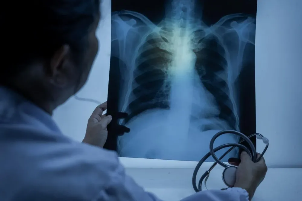 Idosos são mais de 82% dos mortos por pneumonia na Bahia