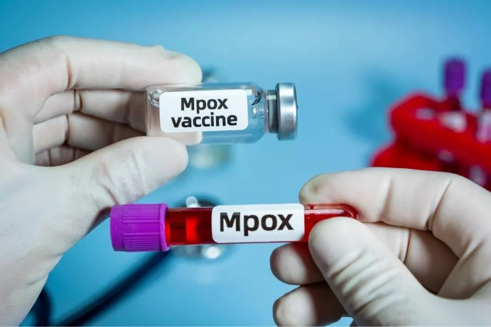 Brasil contabiliza 1,5 mil casos de mpox em 2024