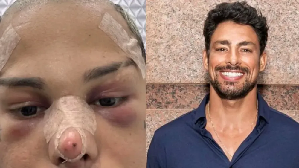 Influencer gasta fortuna para ficar igual a Cauã Reymond; veja resultado 