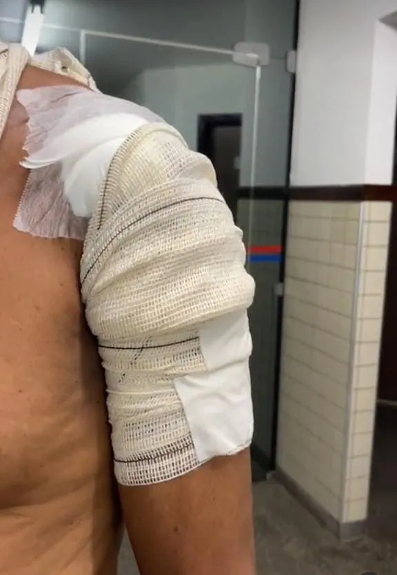 Homem é baleado durante assalto em Vila de Abrantes