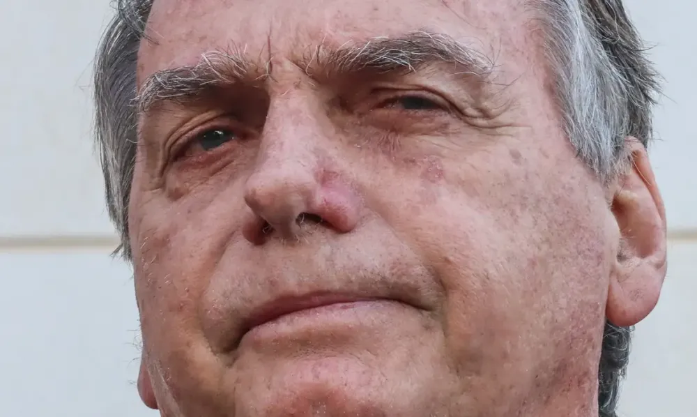 Bolsonaro apresenta piora clínica e vai passar por novos exames
