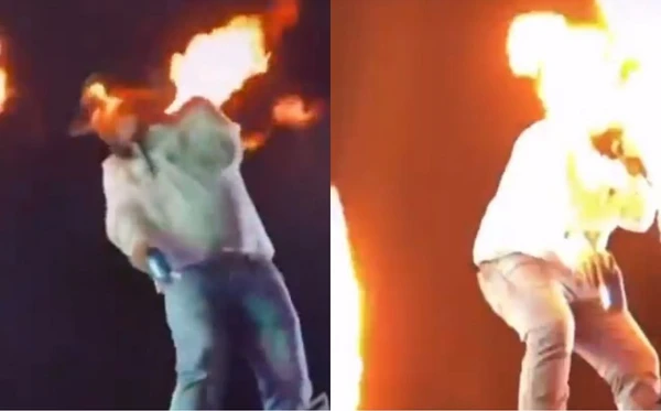 Sertanejo Léo mostra como ficou o rosto após queimaduras em show